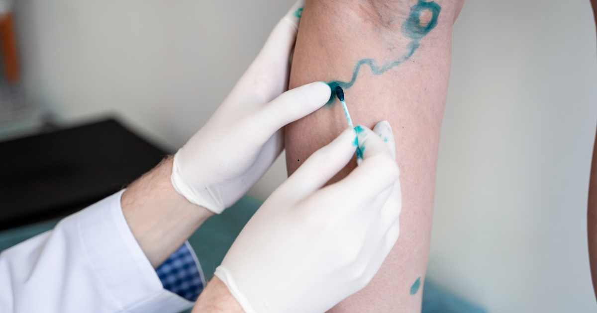 Cirurgião Vascular – Especialista em Saúde da Circulação