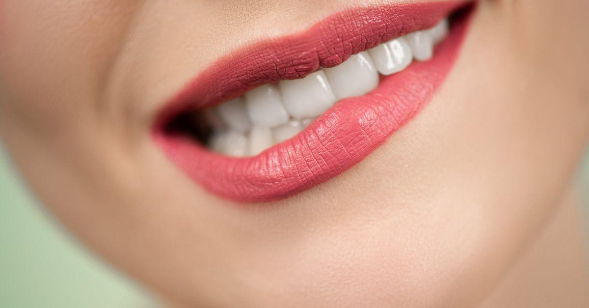 Como conquistar um sorriso mais branco e radiante hoje